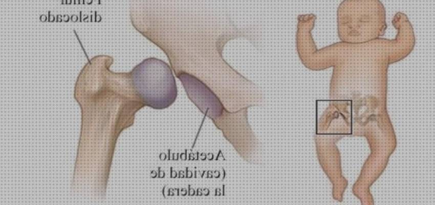 9 Mejores Ortesis Displasias Congenita De Caderas 2021