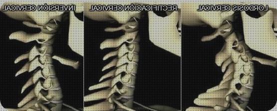 Las mejores rectificacion almohada para rectificacion lordosis cervical