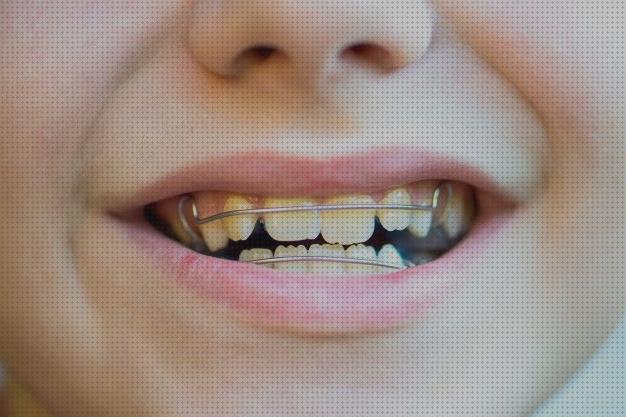 ¿Dónde poder comprar niños aparato ortopedico dental para niños?