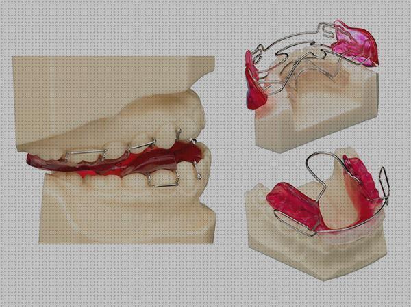 Las mejores aparatos ortopedicos aparatos ortopedicos dentales