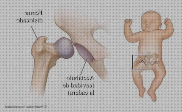 ¿Dónde poder comprar arneses arnes ortopedico displasia de cadera?