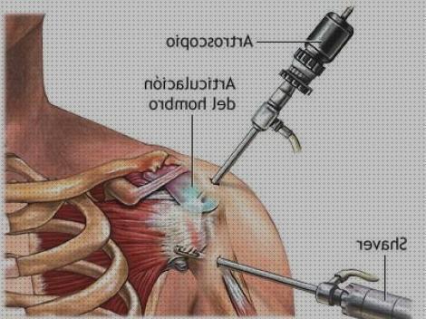 ¿Dónde poder comprar operacion cabestrillo ortopedico operacion hombr0?