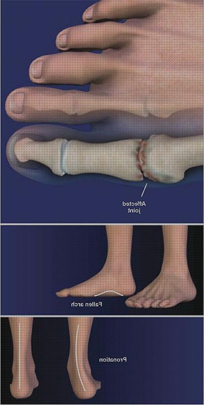 Las mejores columna cervical rectificada kons bambas ortopédicas almohada de viaje cervical concord capsulitis dedo gordo pie