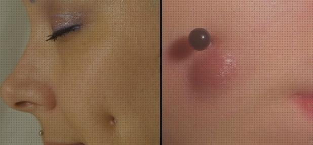 Review de cicaplast piercing