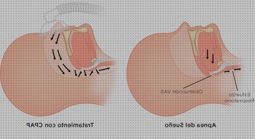 Las mejores almohada cervical cpap cpap terapia respiratoria