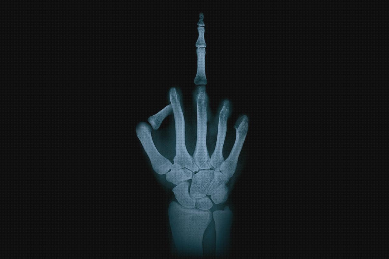 ¿Dónde poder comprar dedo ortopédico dedo pulgar?