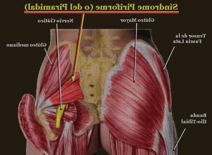 Review de dolor cadera derecha por plantillas ortopedicas