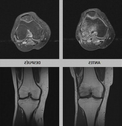 Las mejores marcas de ortopedia bami columna cervical rectificada kons bambas ortopédicas edema oseo rodilla rehabilitacion