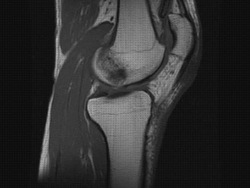 Las mejores ortopedia bami columna cervical rectificada kons bambas ortopédicas edema oseo rodilla rehabilitacion