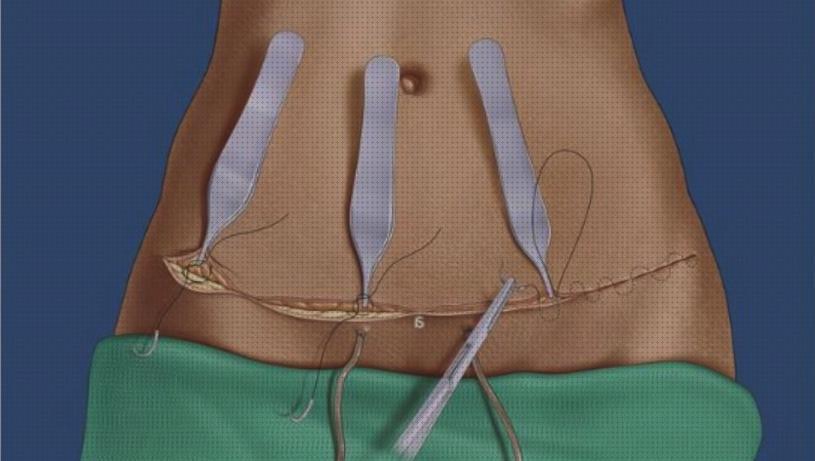 Las mejores marcas de fajas post liposuccion fajas fajas post operatorias abdominoplastia