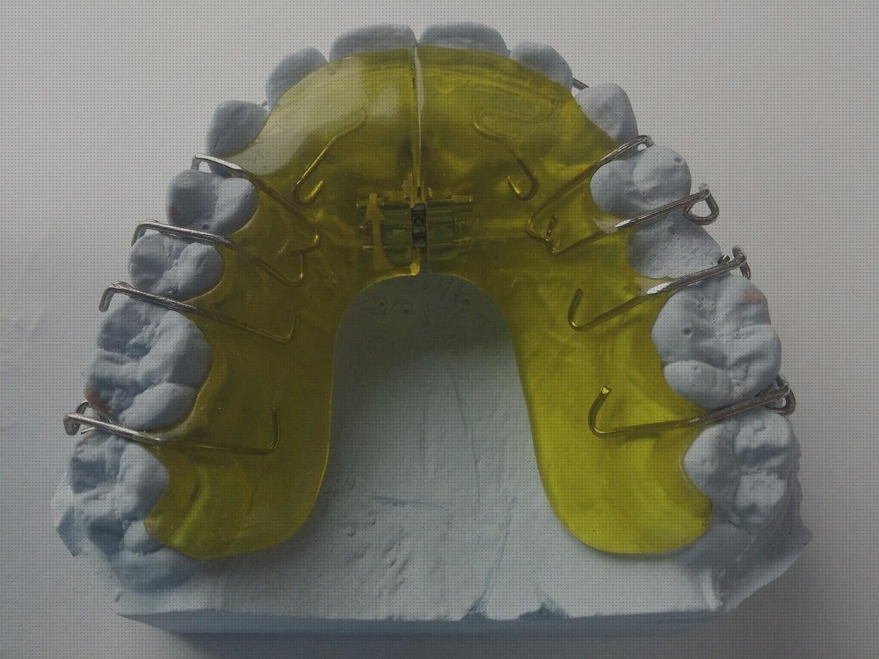 Review de ferula ortopédica dental