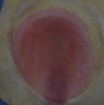 Las mejores marcas de ortesis uvula