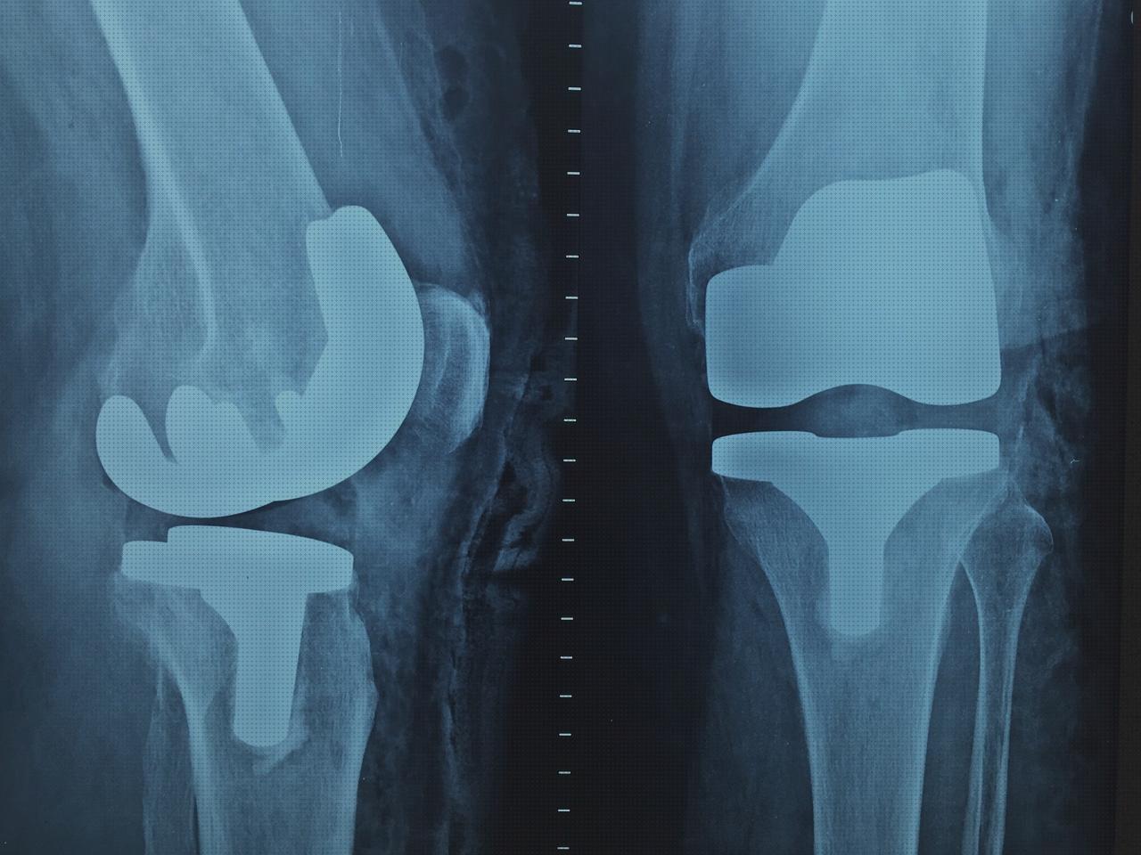 Las mejores marcas de ortopedias ortopedia precision