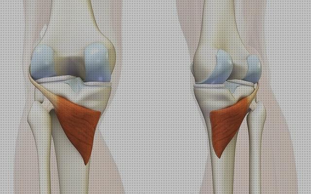 ¿Dónde poder comprar tendinitis aquilea tratamiento ortopédico popliteo tendinitis?