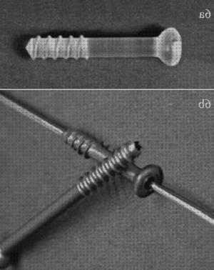 ¿Dónde poder comprar ortopedicos tornillos de platino ortopedicos?