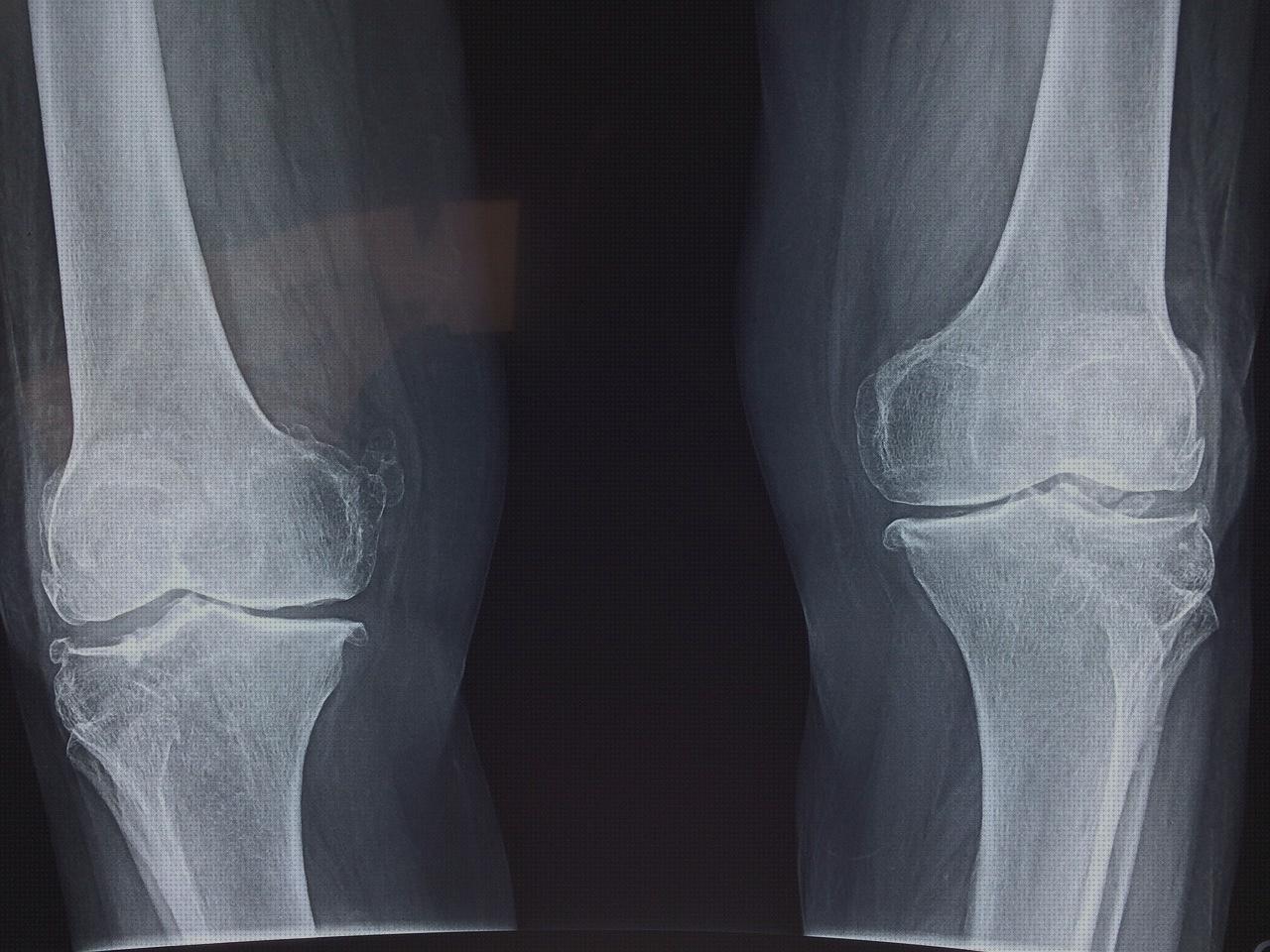 Los 21 Mejores traumatologia ortopédicos